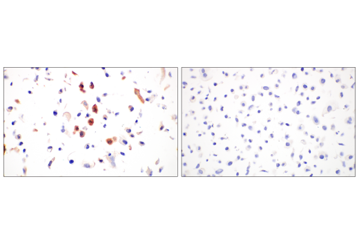 Immunohistochemistry Image 3: SARS-CoV-2 Nucleocapsid Protein (HL344) Rabbit mAb
