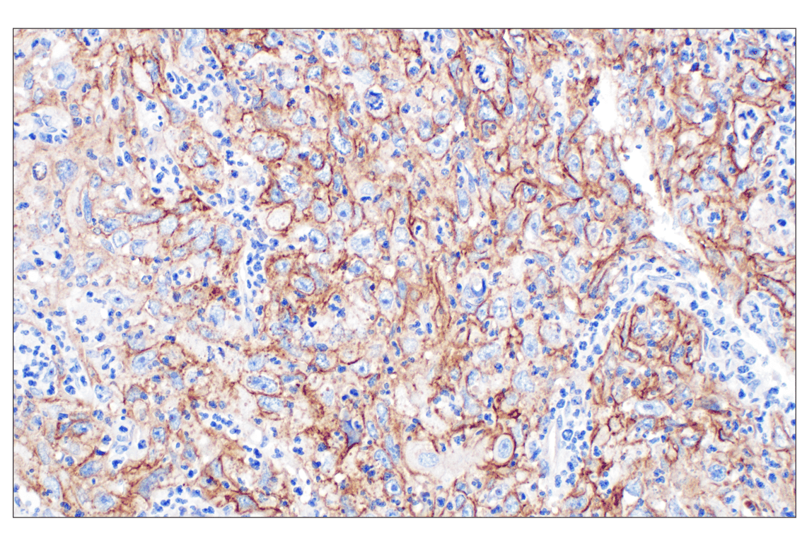 Immunohistochemistry Image 4: CD44 v5 (C44Mab-3) Mouse mAb