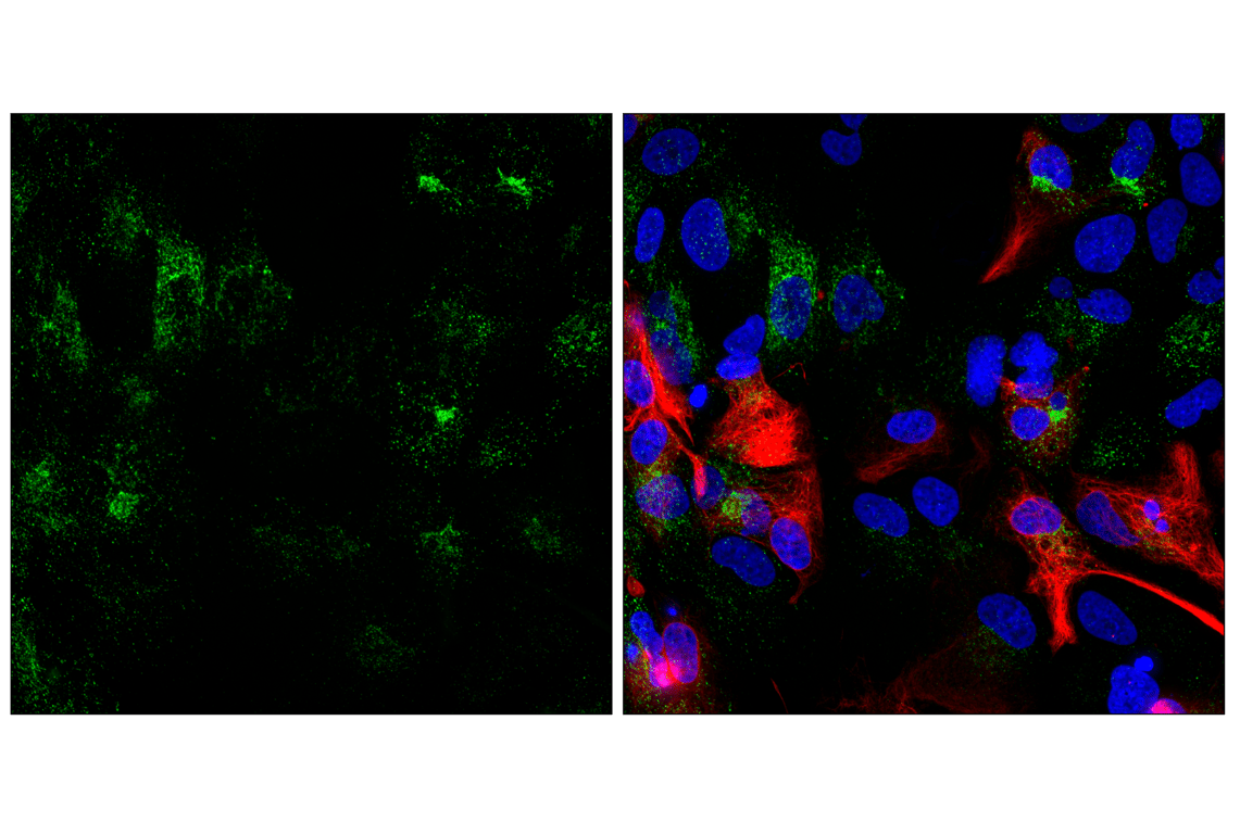 Immunofluorescence Image 1: AQP4 (D1F8E) XP<sup>®</sup> Rabbit mAb
