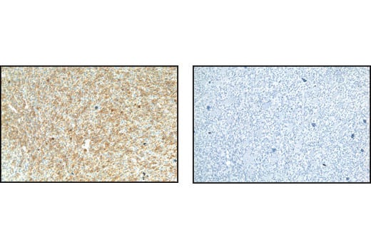 Immunohistochemistry Image 2: Phospho-Met (Tyr1234/1235) (D26) XP<sup>®</sup> Rabbit mAb (BSA and Azide Free)