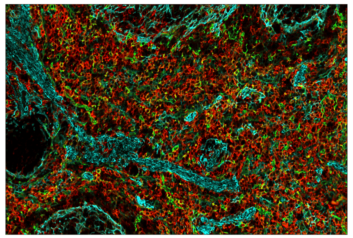 Immunohistochemistry Image 1: CD206/MRC1 (E6T5J) & CO-0032-647 SignalStar<sup>™</sup> Oligo-Antibody Pair