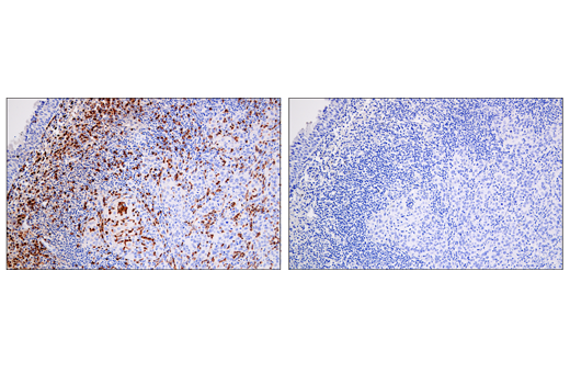 Immunohistochemistry Image 4: Arginase-1 (E4U1I) Mouse mAb (BSA and Azide Free)
