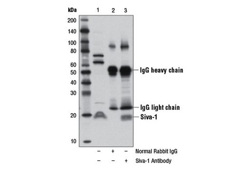 Western Blotting Image 3: Siva-1 Antibody