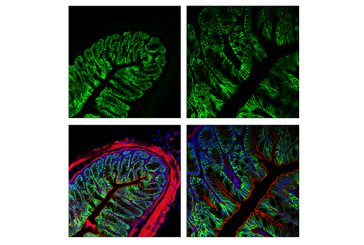 Immunofluorescence Image 3: AQP4 (D1F8E) XP<sup>®</sup> Rabbit mAb (BSA and Azide Free)