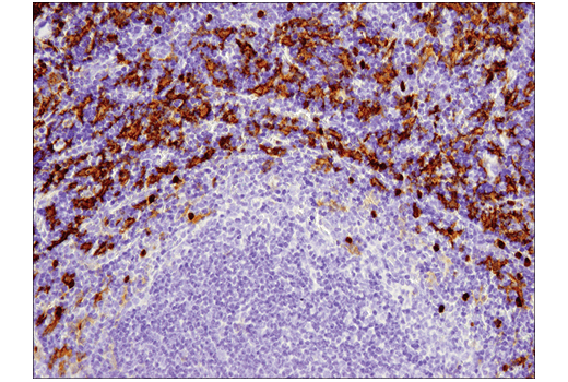 undefined Image 20: Mouse Reactive M1 vs M2 Macrophage IHC Antibody Sampler Kit