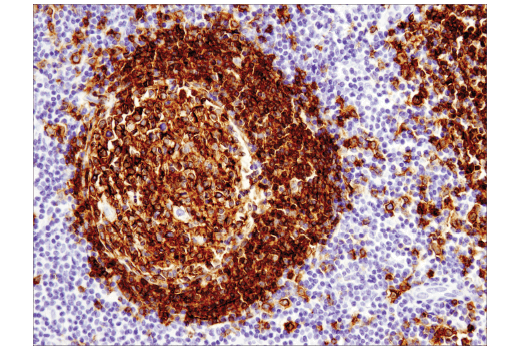 Immunohistochemistry Image 4: CD19 (Intracellular Domain) (D4V4B) XP<sup>®</sup> Rabbit mAb