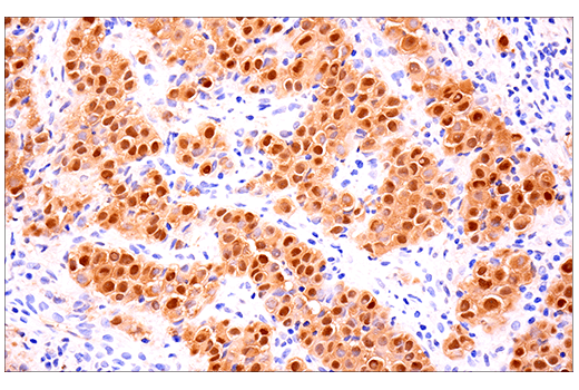 Immunohistochemistry Image 6: Calretinin (E7R6O) XP<sup>®</sup> Rabbit mAb