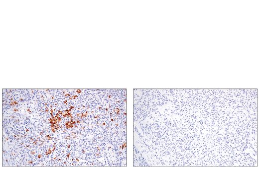 Immunohistochemistry Image 2: CSF-1R/M-CSF-R (E4T8Z) Rabbit mAb