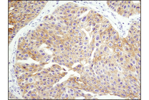 Immunohistochemistry Image 2: HER3/ErbB3 (D22C5) XP<sup>®</sup> Rabbit mAb