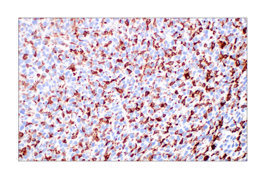 undefined Image 41: Mouse Reactive M1 vs M2 Macrophage IHC Antibody Sampler Kit