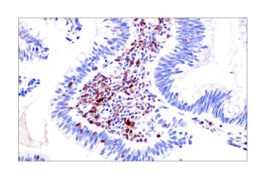undefined Image 50: Human Exhausted CD8<sup>+</sup> T Cell IHC Antibody Sampler Kit