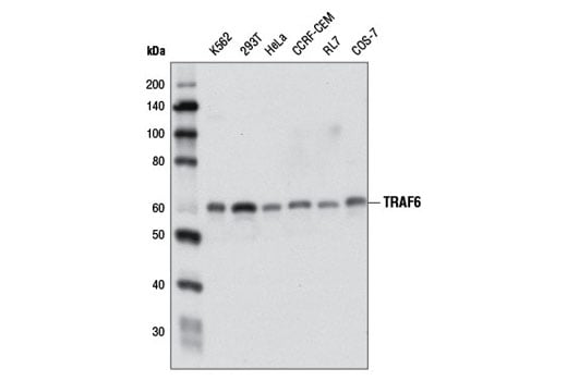 Western Blotting Image 2: TRAF6 (D21G3) Rabbit mAb