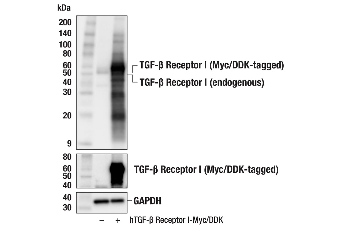 Western Blotting Image 2: TGF-β Receptor I (F6L3I) Rabbit mAb