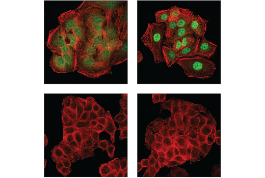 Immunofluorescence Image 1: SMAD4 (D3R4N) XP<sup>®</sup> Rabbit mAb