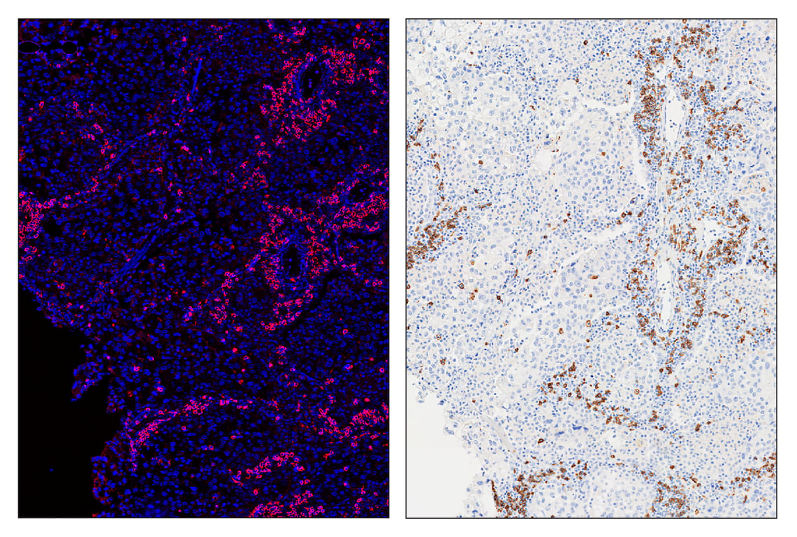 Immunohistochemistry Image 6: CD20 (E7B7T) & CO-0011-750 SignalStar<sup>™</sup> Oligo-Antibody Pair