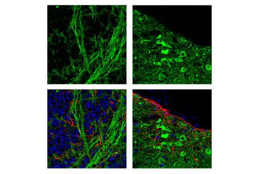 Immunofluorescence Image 3: UCHL1 (D3T2E) XP<sup>®</sup> Rabbit mAb