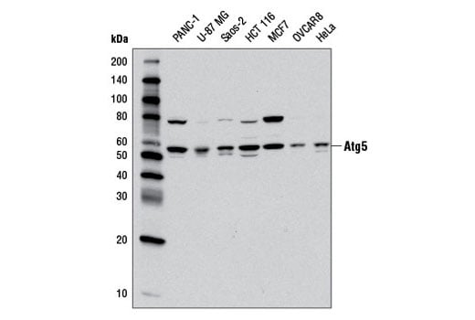 Western Blotting Image 1: Atg5 (D6M7Q) Rabbit mAb