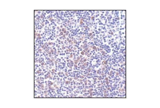 undefined Image 5: PhosphoPlus<sup>®</sup> Bad (Ser112) Antibody Duet