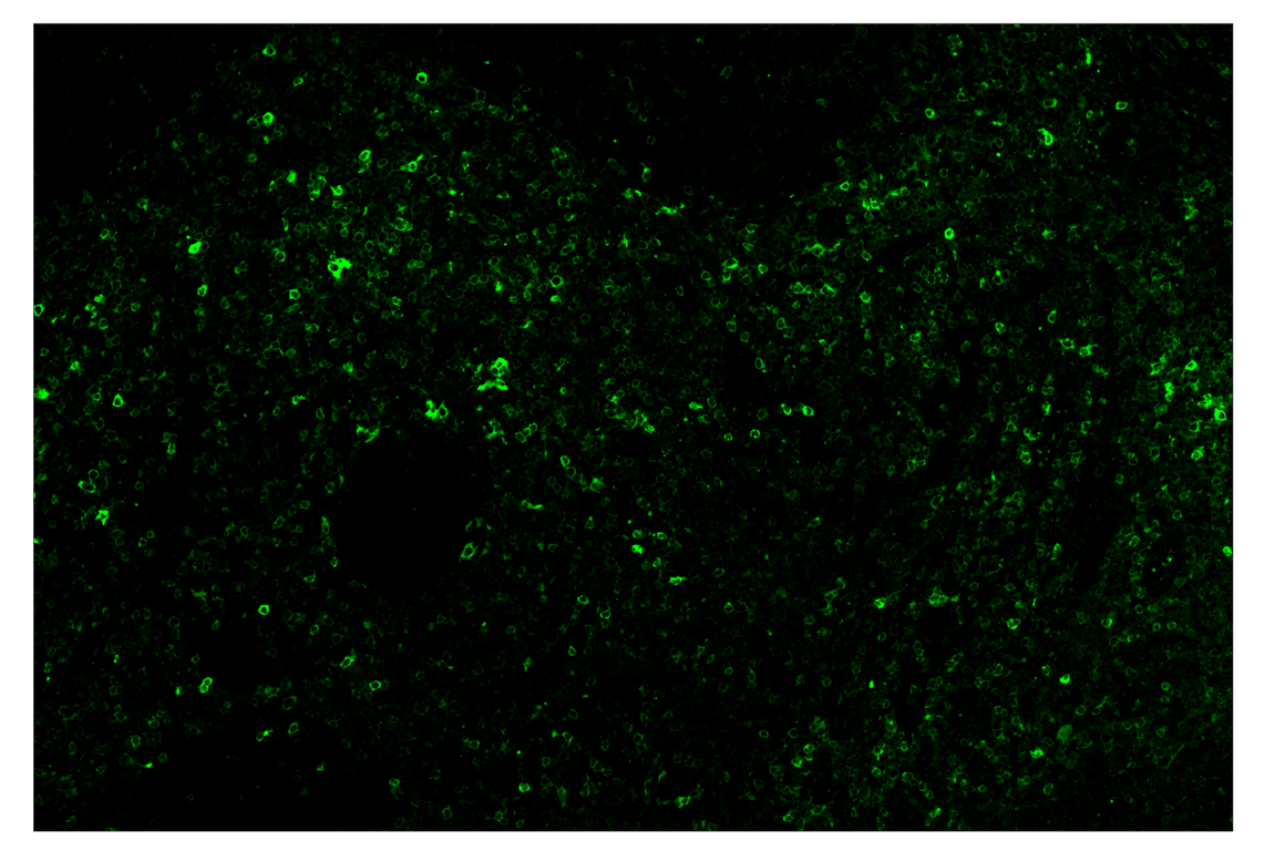 Immunohistochemistry Image 2: Phospho-SLP-76 (Ser376) (E3G9U) & CO-0018-750 SignalStar<sup>™</sup> Oligo-Antibody Pair