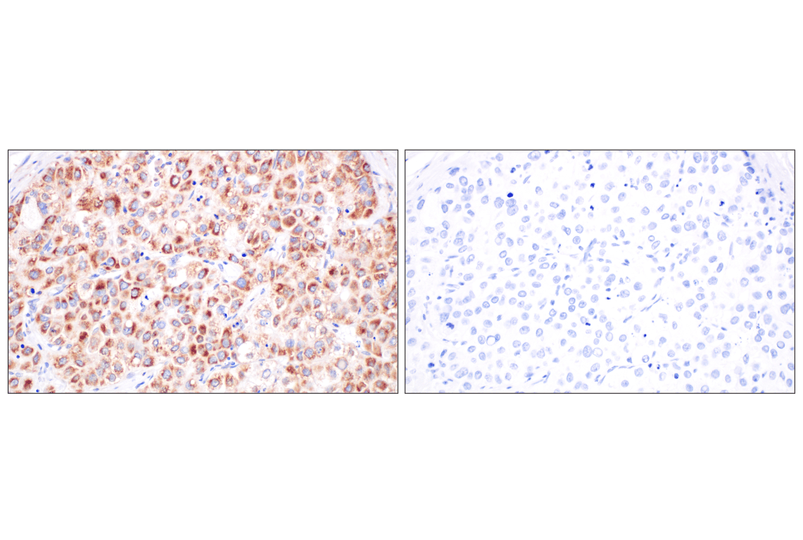 Immunohistochemistry Image 8: CPT1A (E3Y1V) Rabbit mAb