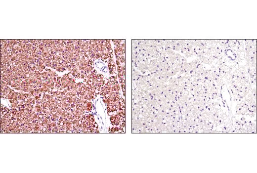 Immunohistochemistry Image 2: Perilipin-1 (D1D8) XP<sup>®</sup> Rabbit mAb