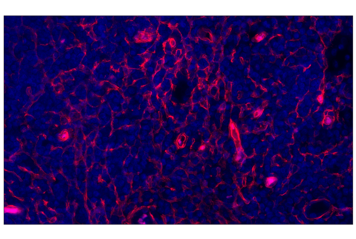 Immunohistochemistry Image 1: CD141/Thrombomodulin (E7Y9P) XP<sup>®</sup> Rabbit mAb (Alexa Fluor<sup>®</sup> 555 Conjugate)