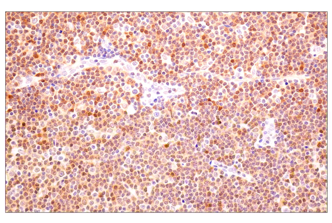 Immunohistochemistry Image 2: ACBP/DBI (E4V8V) XP<sup>®</sup> Rabbit mAb
