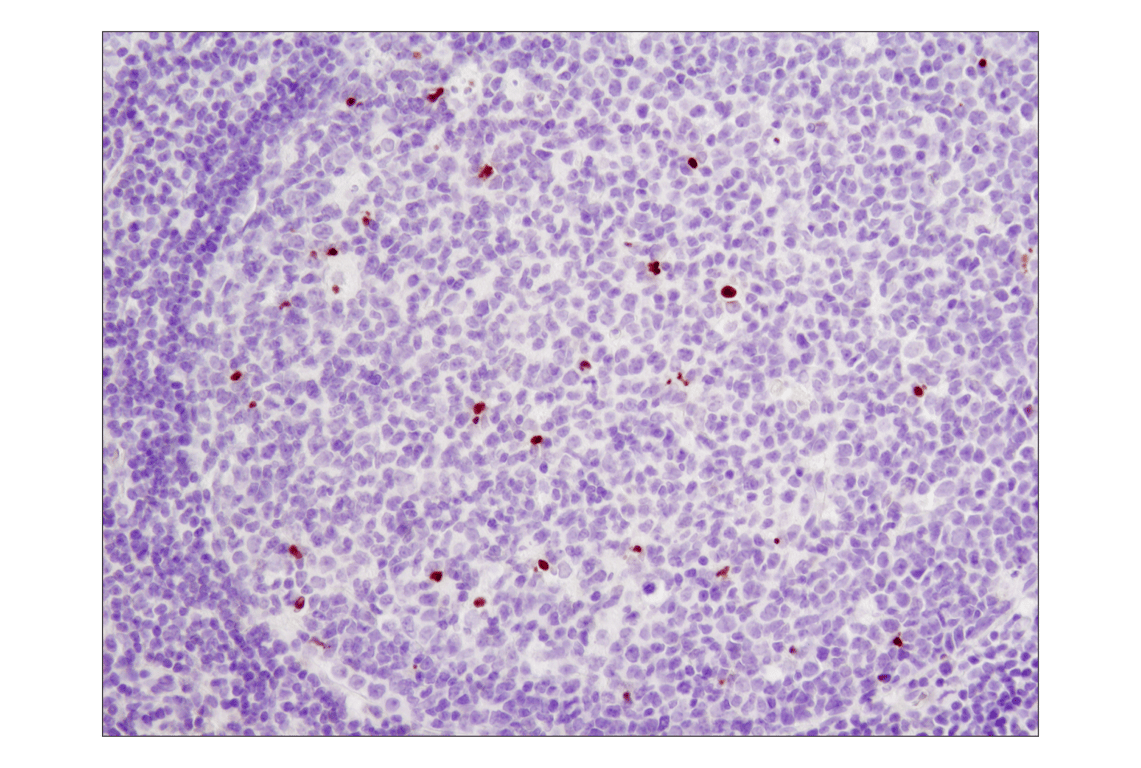 undefined Image 14: Human Reactive Cell Death and Autophagy Antibody Sampler Kit