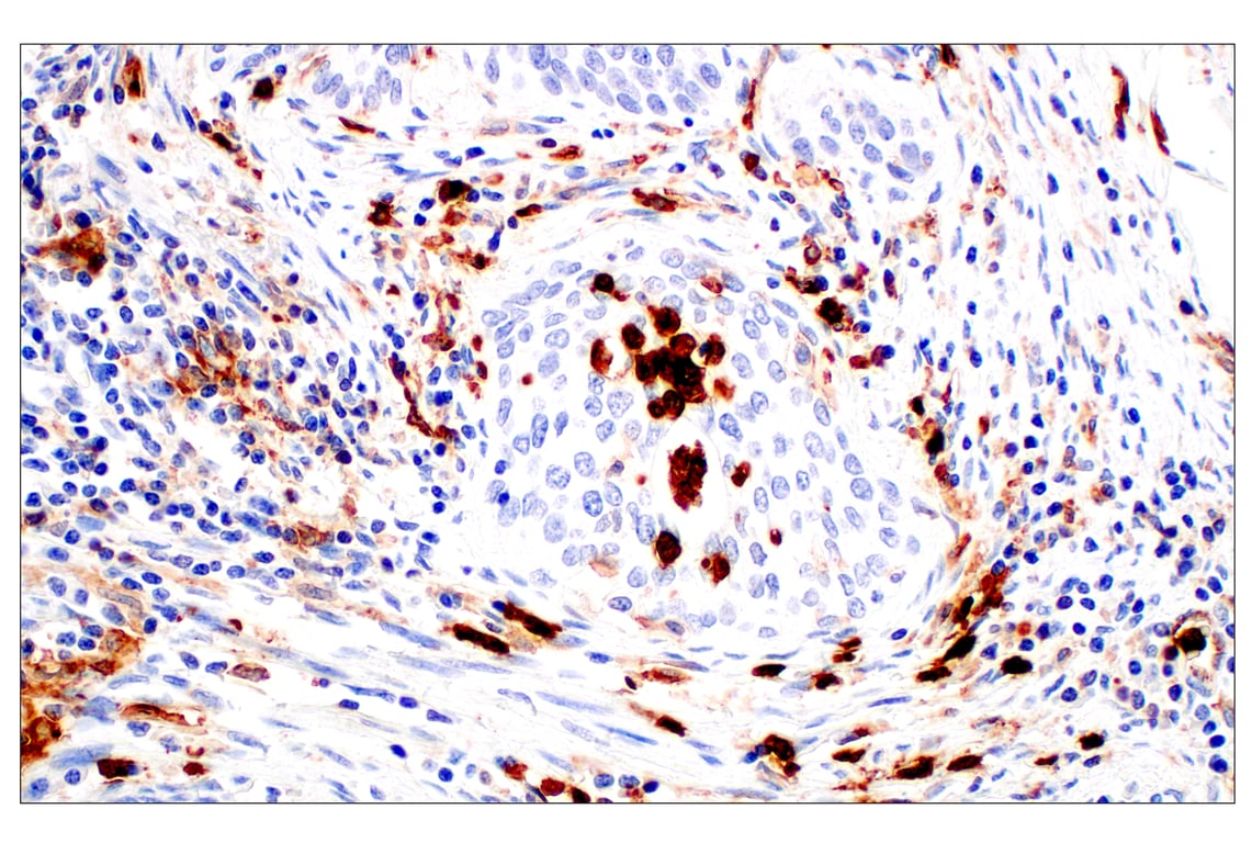Immunohistochemistry Image 9: CD11b/ITGAM (E3J2F) Rabbit mAb