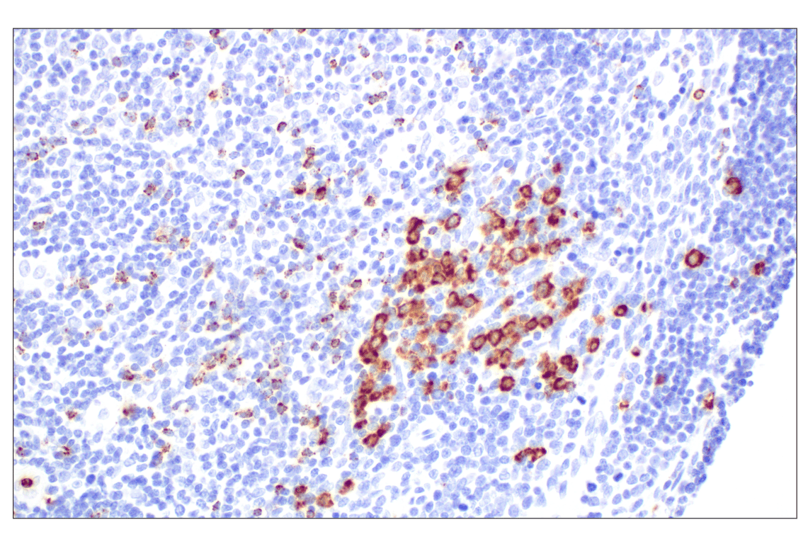 Immunohistochemistry Image 9: NKG7 (F4V5I) Rabbit mAb (BSA and Azide Free)