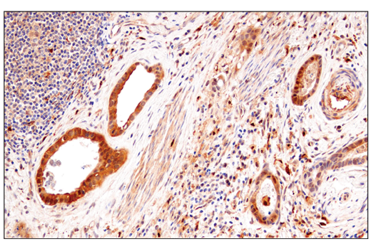 Immunohistochemistry Image 4: Enolase-2 (E2H9X) XP<sup>®</sup> Rabbit mAb