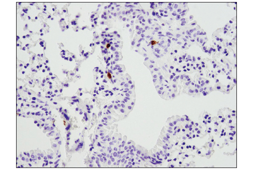 Immunohistochemistry Image 4: PD-1 (Intracellular Domain) (D7D5W) XP<sup>®</sup> Rabbit mAb