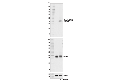 Western Blotting Image 1: Phospho-STING (Ser366) (D7C3S) Rabbit mAb