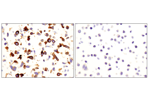 Immunohistochemistry Image 6: CD163 (D6U1J) Rabbit mAb (BSA and Azide Free)