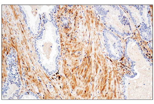 Immunohistochemistry Image 8: Enolase-2 (E2H9X) XP<sup>®</sup> Rabbit mAb