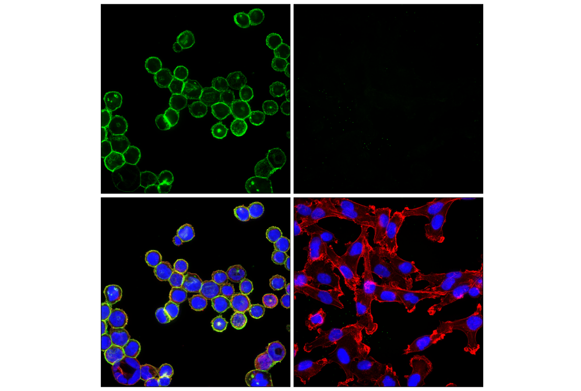 Immunofluorescence Image 1: HER2/ErbB2 (29D8) Rabbit mAb (Alexa Fluor<sup>®</sup> 488 Conjugate)