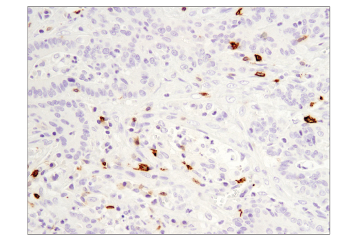 Immunohistochemistry Image 2: OX40 (E9U7O) XP<sup>®</sup> Rabbit mAb (BSA and Azide Free)