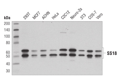 Western Blotting Image 1: SS18 (D6I4Z) Rabbit mAb