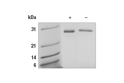 Human Galectin-3/LGALS3 Recombinant Protein: Image 1