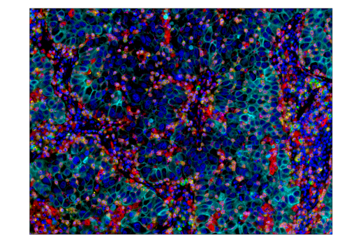 Immunohistochemistry Image 4: LAG3 (D2G4O<sup>™</sup>) XP<sup>®</sup> Rabbit mAb (BSA and Azide Free)