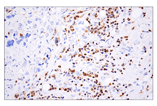 Immunohistochemistry Image 1: HPK1 (E1C3L) Rabbit mAb (BSA and Azide Free)