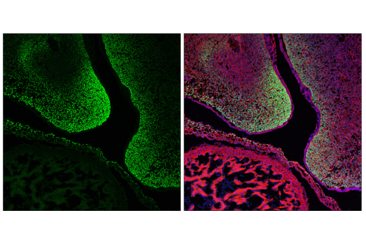 undefined Image 71: Epithelial-Mesenchymal Transition (EMT) IF Antibody Sampler Kit