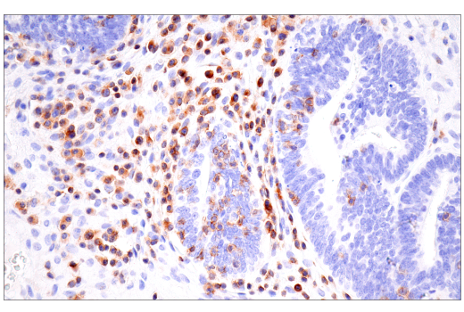 Immunohistochemistry Image 10: SLAMF6/CD352 (E3H1E) XP<sup>®</sup> Rabbit mAb (BSA and Azide Free)