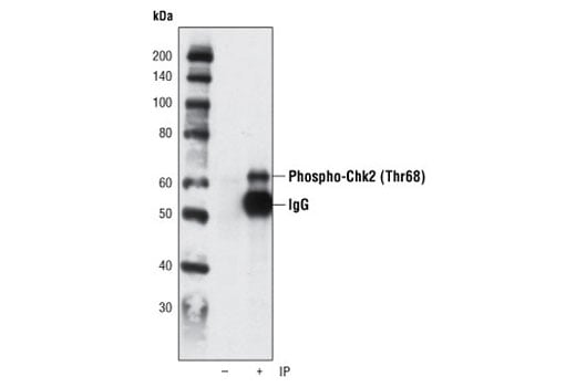 undefined Image 2: PhosphoPlus<sup>®</sup> Chk2 (Thr68) Antibody Duet