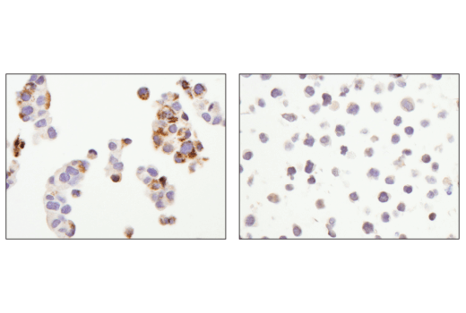 Immunohistochemistry Image 2: Arginase-2 (D9J1N) XP<sup>®</sup> Rabbit mAb