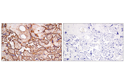 Immunohistochemistry Image 6: CD141/Thrombomodulin (E7Y9P) XP<sup>®</sup> Rabbit mAb (BSA and Azide Free)