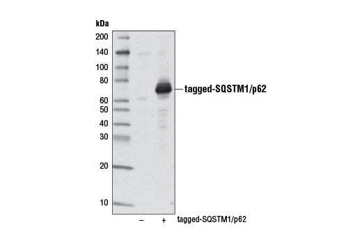 undefined Image 34: Mitophagy Antibody Sampler Kit