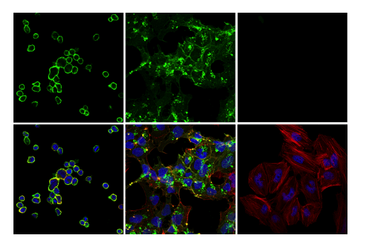 Immunofluorescence Image 1: TNFRSF8/CD30 (E7E4D) XP<sup>®</sup> Rabbit mAb (BSA and Azide Free)