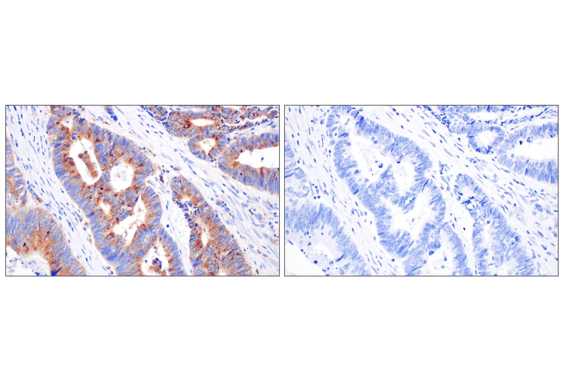Immunohistochemistry Image 11: Cathepsin A (F8X9E) Rabbit mAb