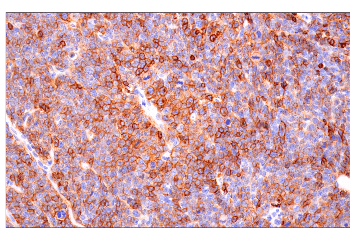 Immunohistochemistry Image 1: CD22 (F9D1W) Rabbit mAb (BSA and Azide Free)